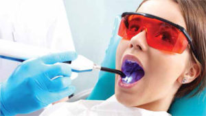 FOTONA Laser Technology in San Antonio