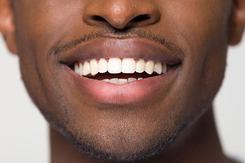 Airway Dentistry in San Antonio