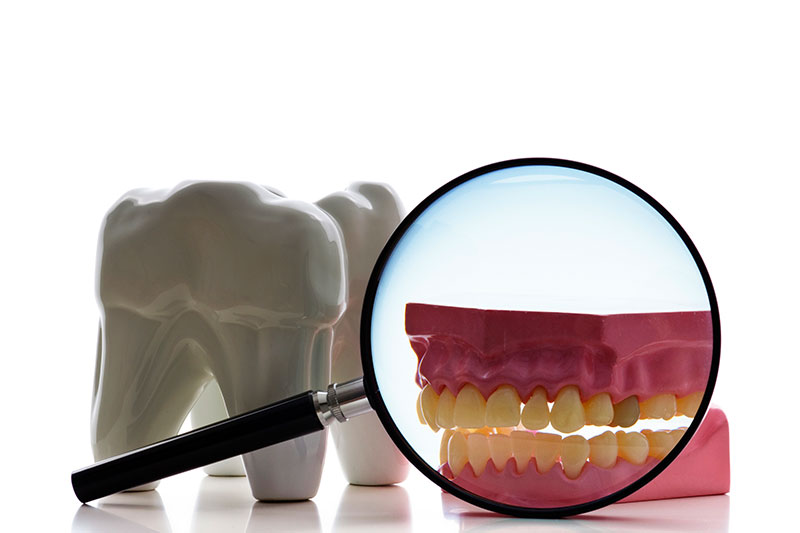 Root Canal Alternatives in San Antonio