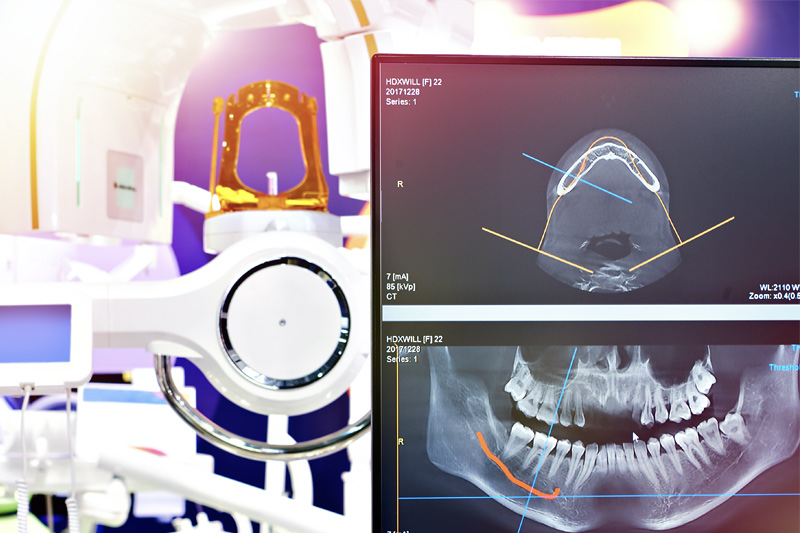 Digital X-Rays in San Antonio